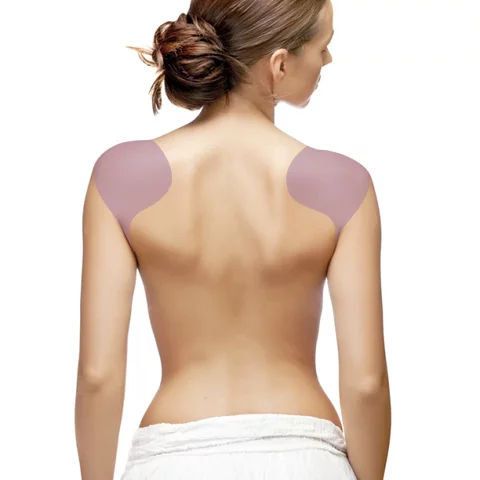 Лазерная эпиляция плечевого пояса для женщин